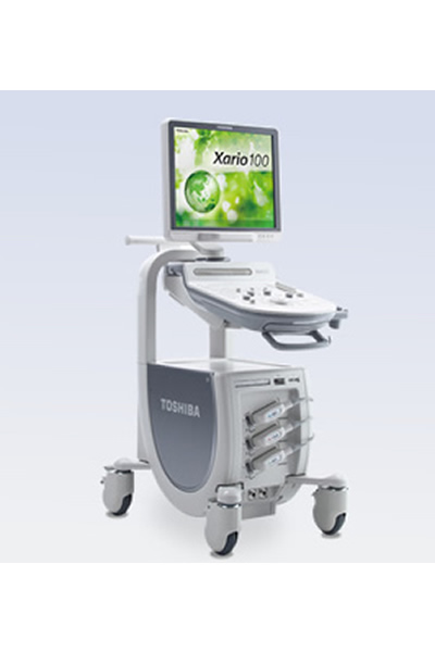 超音波診断装置：Xario100